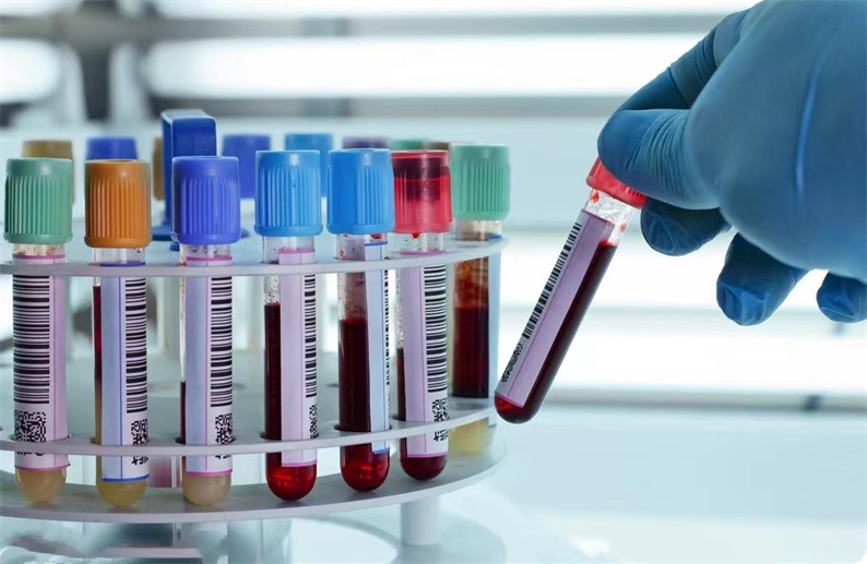 61baef2295e72.jpg 61baef2295e72.jpg